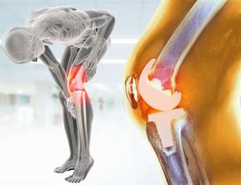 skeleton-showing-knee-joint-trauma