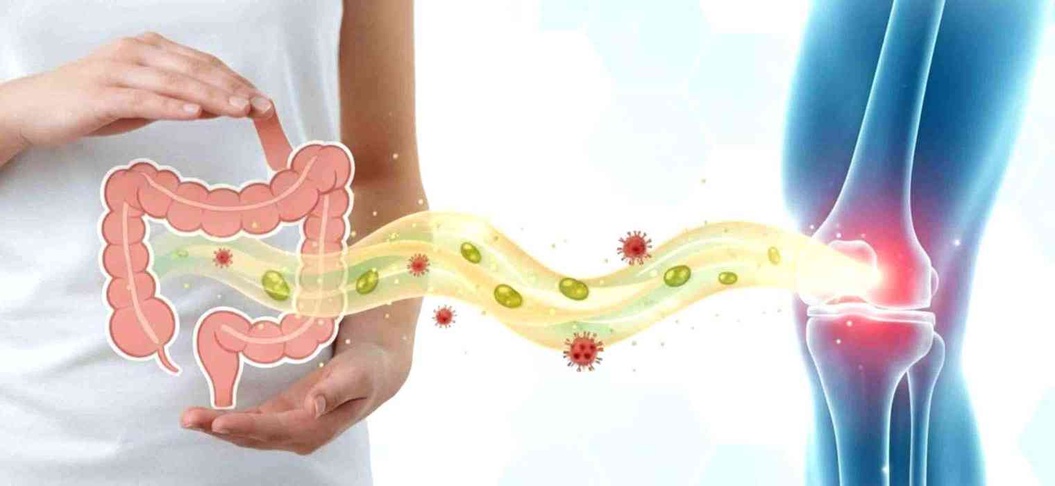 The Gut-Joint Connection: How Your Microbiome Influences Autoimmune Arthritis